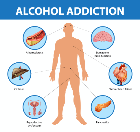 alcohol-addiction-symptoms