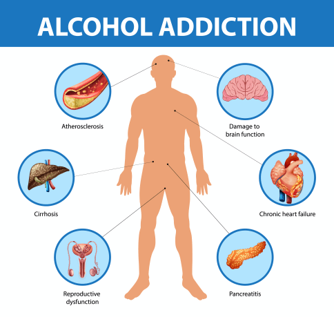 Alcohol Addiction Symptoms